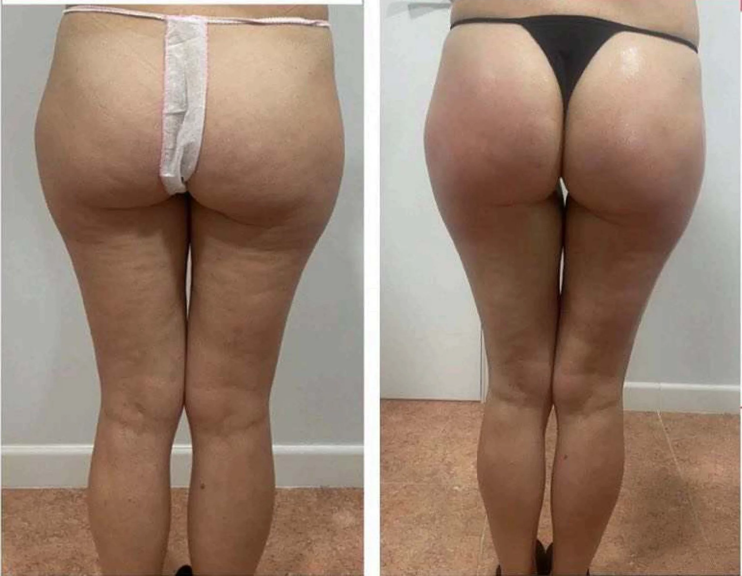 Zionic before and after result 1