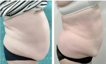 Zionic before and after result 3